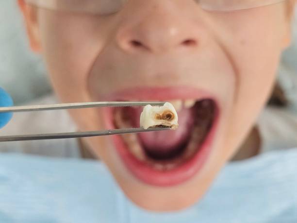 Tooth Infection Emergency Dentist in NJ